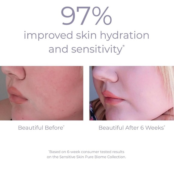 $10❤️‍🔥 LAST 1! Derma E Pure Biome Balancing Serum 💧 NEW IN BOX Cica Redness - Picture 4 of 7